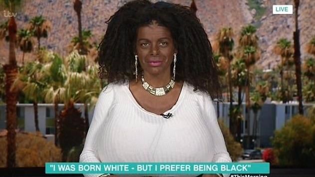 Woman Who Dyed Her Skin Is Going To Africa To Learn To Be Black